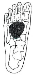Pro-Tec Metatarsal Lifts - Black